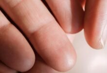 unknown contact phone numbers